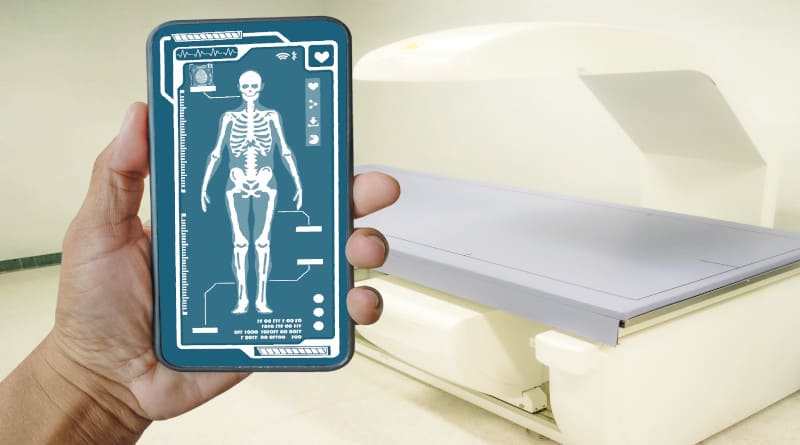 Foto do médico mostrando a imagem da varredura de densidade óssea dxa em um smartphone em análise no holograma humano